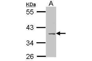 WB Image Sample (30 ug of whole cell lysate) A: Molt-4 , 10% SDS PAGE antibody diluted at 1:1000 (MC1 Receptor 抗体  (C-Term))
