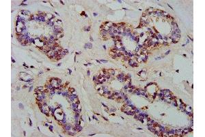 IHC image of ABIN7143526 diluted at 1:300 and staining in paraffin-embedded human breast cancer performed on a Leica BondTM system. (ARFRP1 抗体  (AA 1-201))