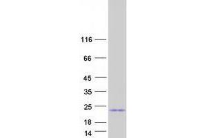 Validation with Western Blot