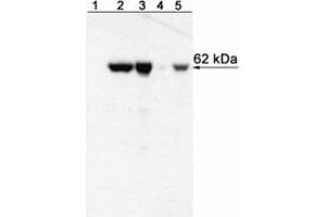 Western Blotting (WB) image for anti-T-Bet antibody (ABIN967673) (T-Bet 抗体)