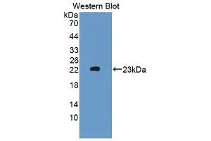 Detection of Recombinant MTMR9, Mouse using Polyclonal Antibody to Myotubularin Related Protein 9 (MTMR9) (MTMR9 抗体  (AA 1-167))