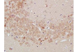 Immunohistochemistry (Paraffin-embedded Sections) (IHC (p)) image for anti-Neurotrophic Tyrosine Kinase, Receptor, Type 1 (NTRK1) (AA 725-821) antibody (ABIN726110)