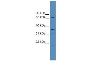 Western Blot showing SF4 antibody used at a concentration of 1-2 ug/ml to detect its target protein. (Splicing Factor 4 抗体  (C-Term))