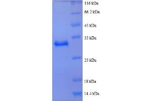 SDS-PAGE (SDS) image for Actin, beta (ACTB) (AA 102-375), (partial) protein (His tag) (ABIN5712171)