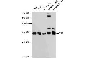 Western blot analysis of extracts of various cell lines, using CBR1 antibody (ABIN7266076) at 1:1000 dilution. (CBR1 抗体)