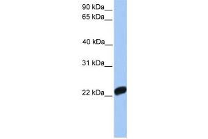 Western Blotting (WB) image for anti-Coagulation Factor X (F10) antibody (ABIN2458605) (Coagulation Factor X 抗体)