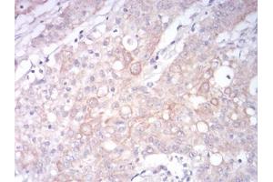 Immunohistochemistry (IHC) image for anti-Low Density Lipoprotein Receptor-Related Protein 1 (LRP1) (AA 20-155) antibody (ABIN5897030) (LRP1 抗体  (AA 20-155))