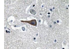 Immunohistochemistry analyzes of CCK antibody in paraffin-embedded human brain tissue. (Cholecystokinin 抗体)