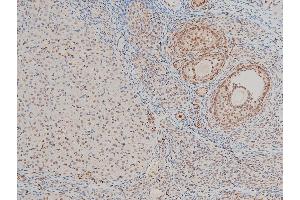 Immunohistochemistry (IHC) image for anti-Cofilin 1 (CFL1) (pSer3) antibody (ABIN6255180)