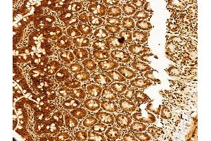 ABIN6255339 and ABIN6267494 at 1/100 staining Rat colon tissue by IHC-P. (SREBF1 抗体  (pSer439))