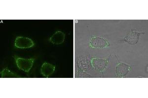 Expression of Orai1 in rat RBL cells - Cell surface detection of Orai1 in intact living rat basophilic leukemia (RBL) cells using Anti-Orai1 (extracellular)-ATTO Fluor-488 Antibody (ABIN7043406), (1:100).