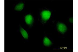 Immunofluorescence of purified MaxPab antibody to FHL1 on HeLa cell. (FHL1 抗体  (AA 1-280))