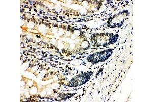 IHC-P: NFKB2 antibody testing of rat intestine tissue (NFKB2 抗体  (N-Term))