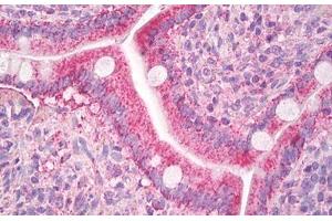Image no. 1 for anti-Chemokine (C-C Motif) Ligand 8 (CCL8) (AA 24-99) antibody (ABIN1499347) (CCL8 抗体  (AA 24-99))
