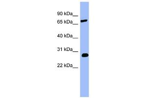WB Suggested Anti-COMT Antibody Titration:  0. (COMT 抗体  (Middle Region))