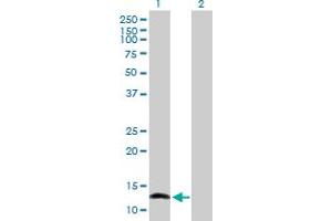 Western Blot analysis of NFATC2IP expression in transfected 293T cell line by NFATC2IP MaxPab polyclonal antibody. (NFATC2IP 抗体  (AA 1-138))