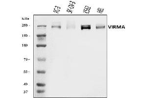 Western blot analysis of KI/VIRMA using anti-KI/VIRMA antibody (ABIN7599707). (Protein Virilizer Homolog (VIRMA) (AA 11-1529) 抗体)