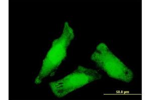 Immunofluorescence of monoclonal antibody to NIPBL on HeLa cell. (NIPBL 抗体  (AA 66-175))