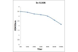 Antigen: 0. (KAT2B 抗体  (AA 451-550))