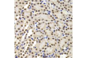 Immunohistochemistry of paraffin-embedded mouse kidney using PPP1R8 Antibody (ABIN5974046) at dilution of 1/100 (40x lens). (PPP1R8 抗体)