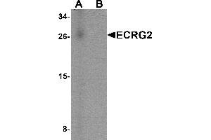 Western blot analysis of ECRG2 in human lung tissue lysate with ECRG2 antibody at 1 µg/mL in (A) the absence and (B) the presence of blocking peptide.