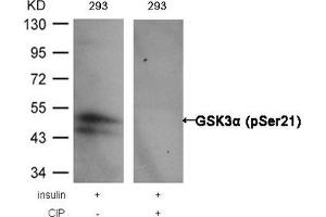 Western blot analysis of extracts from 293 cells, treated with insulin or calf intestinal phosphatase (CIP), using GSK3α (Phospho-Ser21) Antibody. (GSK3 alpha 抗体  (pSer21))