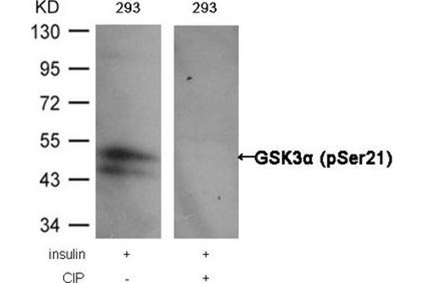 GSK3 alpha 抗体  (pSer21)