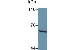 Detection of MMP1 in Caprine Skin lysate using Polyclonal Antibody to Matrix Metalloproteinase 1 (MMP1) (MMP1 抗体  (AA 98-275))