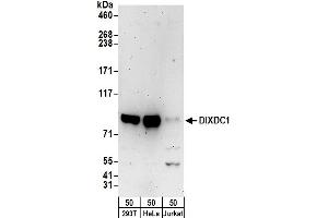 anti-DIX Domain Containing 1 (DIXDC1) (AA 633-683) antibody