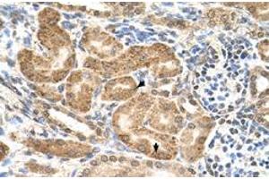 Immunohistochemical staining (Formalin-fixed paraffin-embedded sections) of human kidney with GMPPB polyclonal antibody  at 4-8 ug/mL working concentration. (GMPPB 抗体  (C-Term))