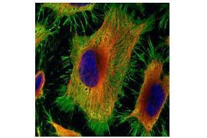 ICC/IF Image Confocal immunofluorescence analysis (Olympus FV10i) of paraformaldehyde-fixed HeLa, using Annexin II, antibody (Green) at 1:500 dilution. (Annexin A2 抗体  (N-Term))
