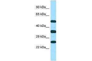 WB Suggested Anti-RAET1E Antibody Titration: 1. (Retinoic Acid Early Transcript 1E (RAET1E) (C-Term) 抗体)