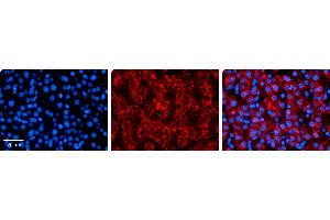 Immunohistochemistry (IHC) image for anti-Mitogen-Activated Protein Kinase Kinase 3 (MAP2K3) (N-Term) antibody (ABIN502211) (MAP2K3 抗体  (N-Term))