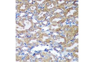 Immunohistochemistry (IHC) image for anti-Heme Binding Protein 2 (HEBP2) (AA 1-205) antibody (ABIN7267604)
