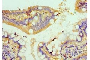 Immunohistochemistry of paraffin-embedded human small intestine tissue using ABIN7149059 at dilution of 1:100 (KAT14 抗体  (AA 523-782))