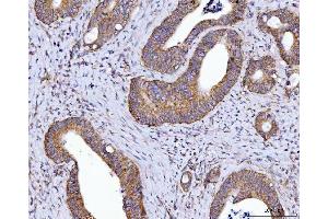 IHC analysis of HAX1 using anti-HAX1 antibody (ABIN7599208).