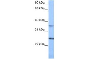 Western Blotting (WB) image for anti-Phosphatidylinositol Glycan F (PIGF) antibody (ABIN2462126) (PIGF 抗体)