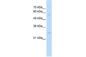 SOCS1 antibody - N-terminal region  validated by WB using Jurkat cell lysate at 0. (SOCS1 抗体  (N-Term))