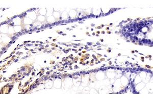 Detection of KMO in Human Colon Tissue using Polyclonal Antibody to Kynurenine-3-Monooxygenase (KMO) (KMO 抗体  (AA 1-374))