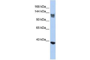 WB Suggested Anti-SMARCA1 Antibody Titration:  0. (SMARCA1 抗体  (N-Term))