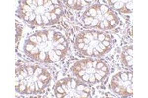 Immunohistochemistry of TEM1 in human colon tissue with this product at 2. (CD248 抗体  (C-Term))