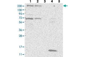Western blot analysis of Lane 1: RT-4, Lane 2: U-251 MG, Lane 3: Human Plasma, Lane 4: Liver, Lane 5: Tonsil with KIAA1244 polyclonal antibody .