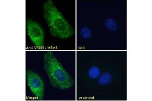 Immunofluorescence (IF) image for anti-Vacuolar Protein Sorting 35 (VPS35) (C-Term) antibody (ABIN185182)