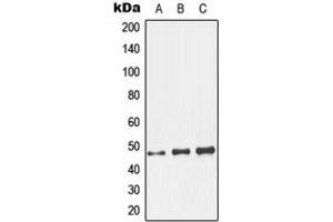 Western blot analysis of GCNT7 expression in HeLa (A), mouse kidney (B), rat kidney (C) whole cell lysates. (GCNT7 抗体  (C-Term))