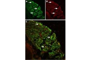 Expression of TRPV2 in mouse DRG - Immunohistochemical staining of TRPV2 in mouse dorsal root ganglion (DRG) using Anti-TRPV2 (VRL1) (extracellular) Antibody (ABIN7043845, ABIN7044002 and ABIN7044003). (TRPV2 抗体  (1st Extracellular Loop))