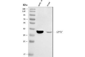 Western blot analysis of OPTC using anti-OPTC antibody (ABIN7601300).
