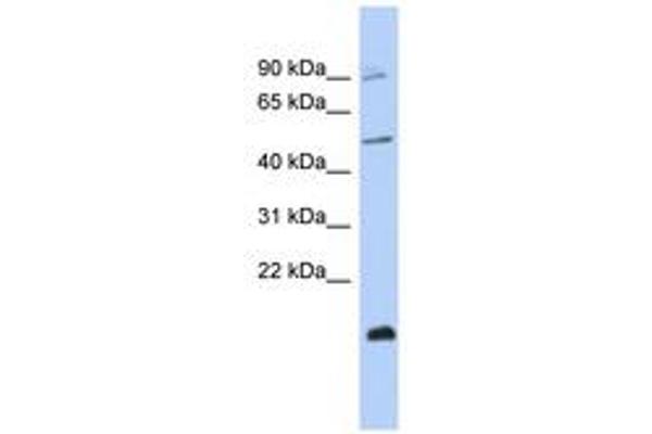 ZNF645 anticorps  (C-Term)