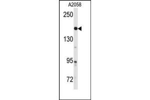 Image no. 1 for anti-ABL2 (ABL2) (Center) antibody (ABIN358073) (ABL2 抗体  (Center))