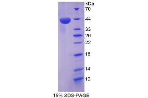 SDS-PAGE (SDS) image for Chemokine (C-X-C Motif) Ligand 12 (CXCL12) (AA 23-89) protein (His tag,GST tag) (ABIN1980661) (CXCL12 Protein (AA 23-89) (His tag,GST tag))