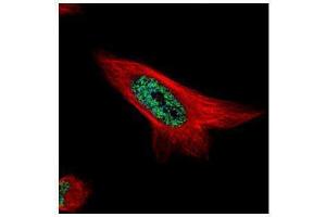 ICC/IF Image Confocal immunofluorescence analysis (Olympus FV10i) of paraformaldehyde-fixed HeLa, using MAML1, antibody (Green) at 1:500 dilution. (MAML1 抗体  (N-Term))
